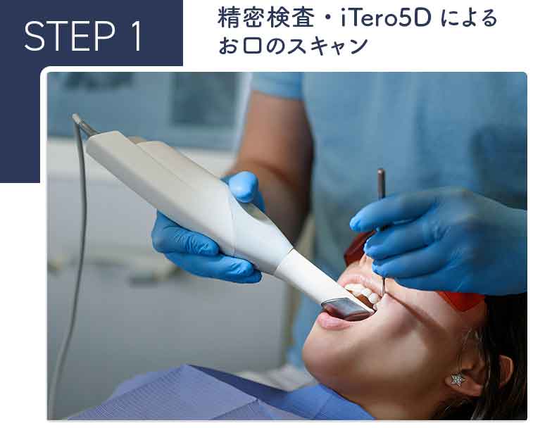 精密検査・iTero5Dによるお口のスキャン