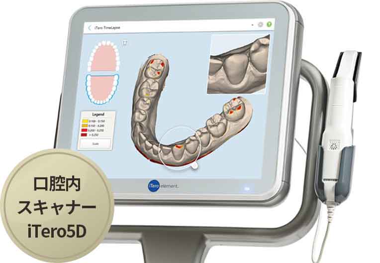 矯正後のイメージをその場で確認