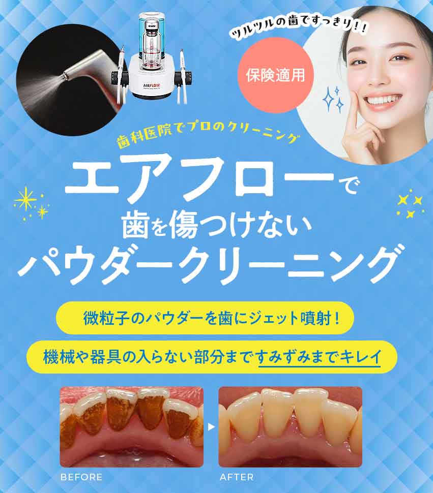 エアフロー