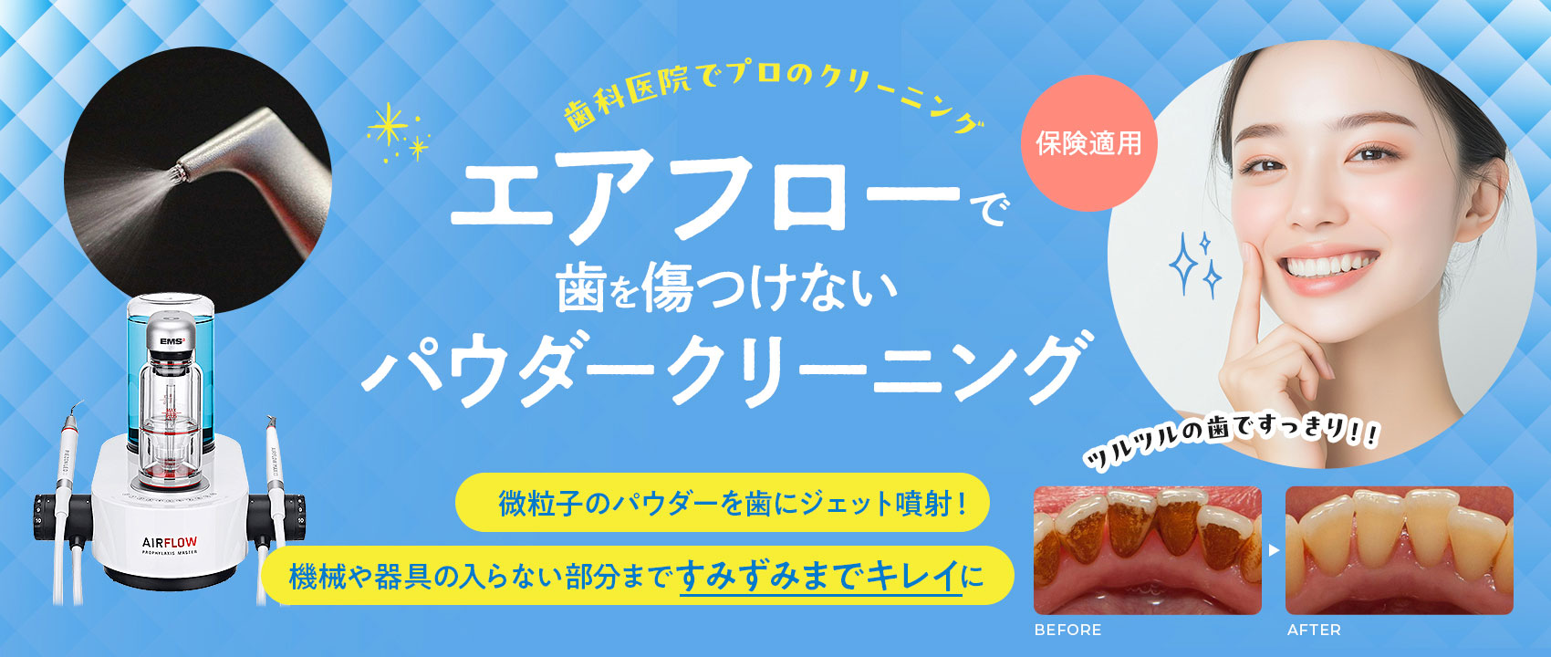 エアフロー