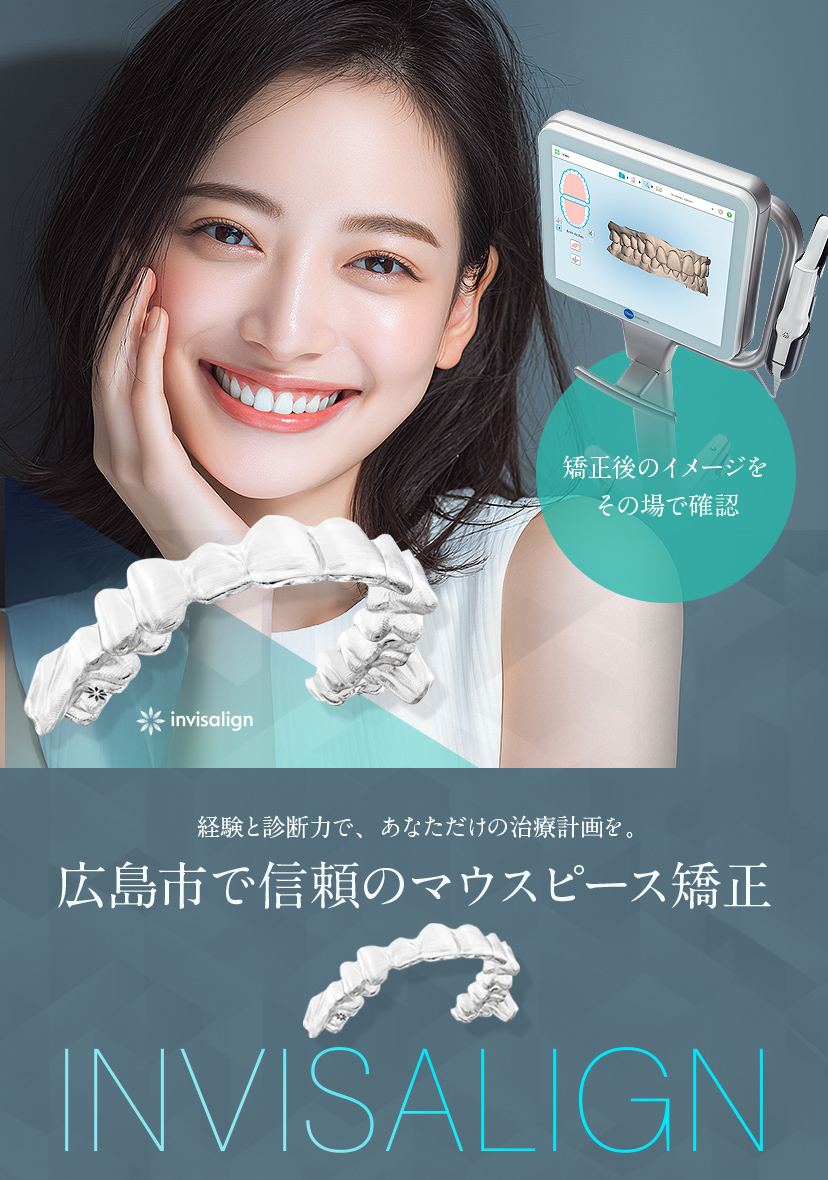 エアフロー