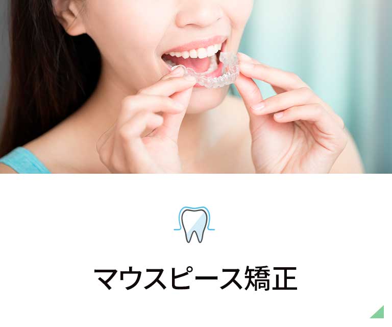 マウスピース型矯正装置