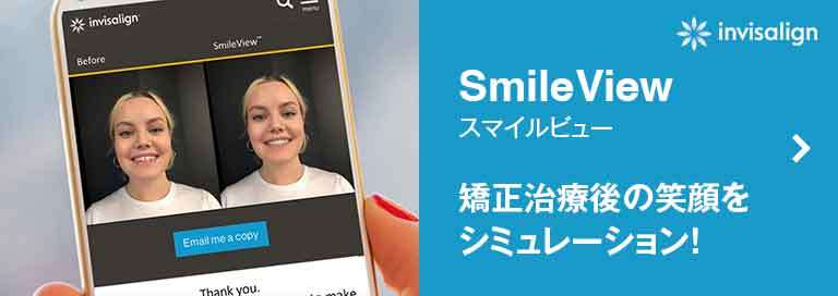 smileview